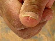 Aspen-Countertops-FingerSave.jpg
