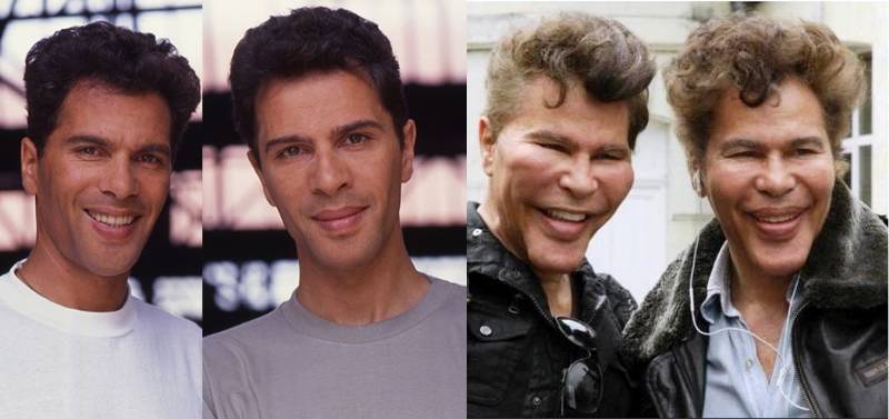 bogdanoff_plastic_surgery.jpg