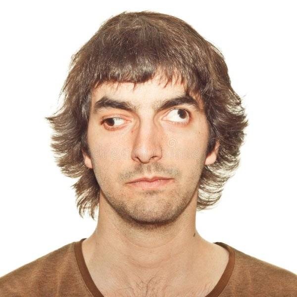 Cross eyed.jpg