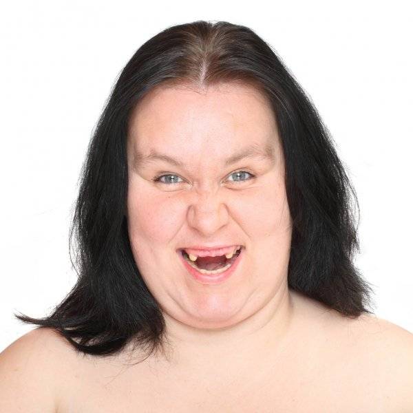 depositphotos_65981387-stock-photo-ugly-woman-with-missing-teeth.jpg