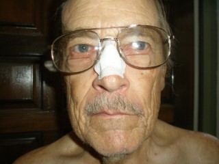 Me Bandaged Up 001 (Phone).JPG