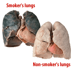 smokers-lungs-comparison1.png