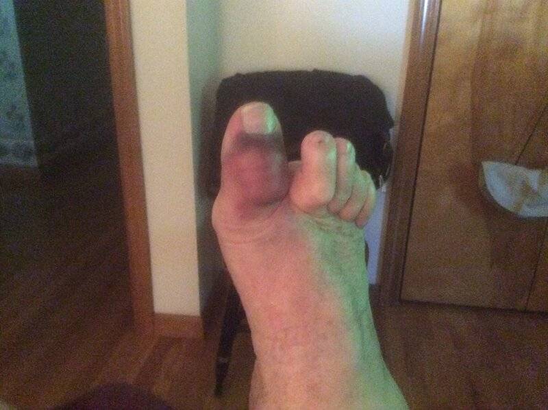 toe.jpg