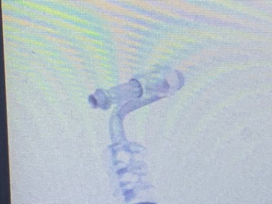 thumbnail_IMG_9413.jpg thumbnail_IMG_9413.jpg