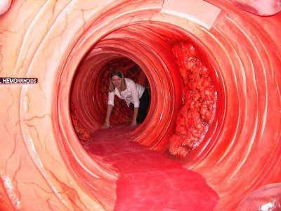 colon.jpg