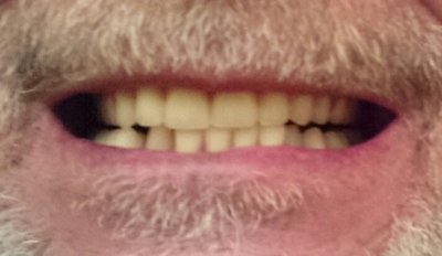 teeth.jpg teeth.jpg