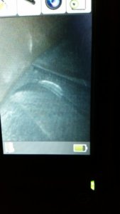 20171214_175531.jpg 20171214_175531.jpg