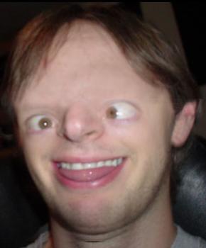 retard.jpg